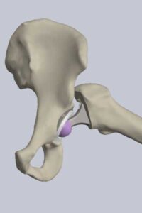 ISO 21535 Bewegungsumfang* 