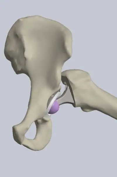 ISO 21535 Bewegungsumfang*