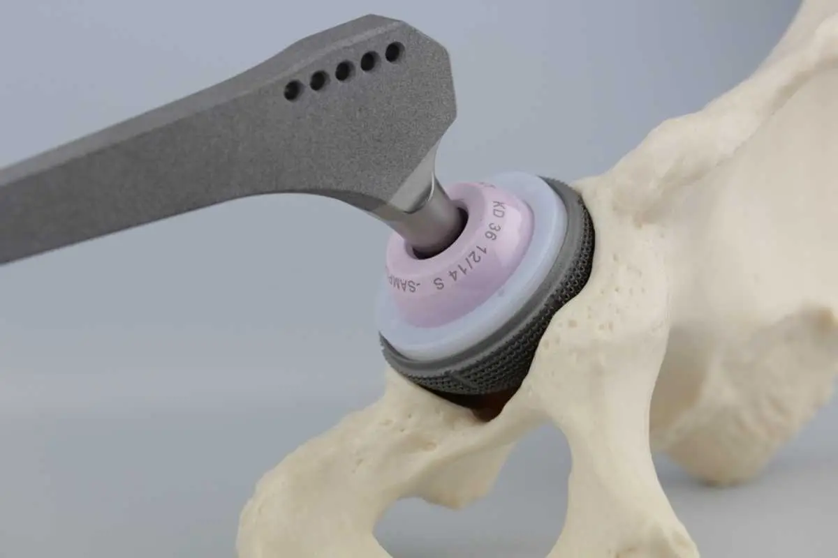 Mechanische Prüfung Hüftendoprothetik